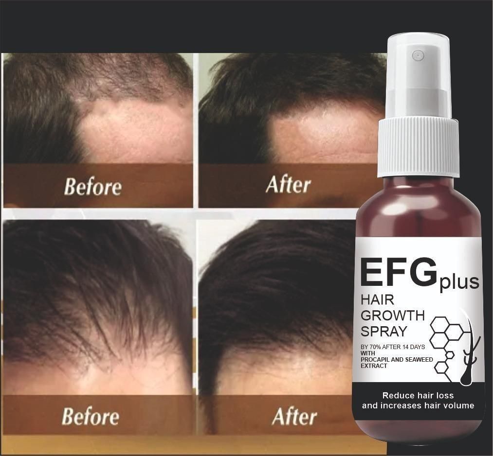 EFGPLUS Hair Growth Spray - Anti Hair Fall Pack for India