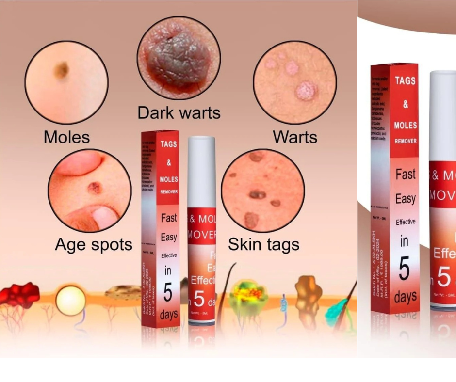 Tags & Moles Remover